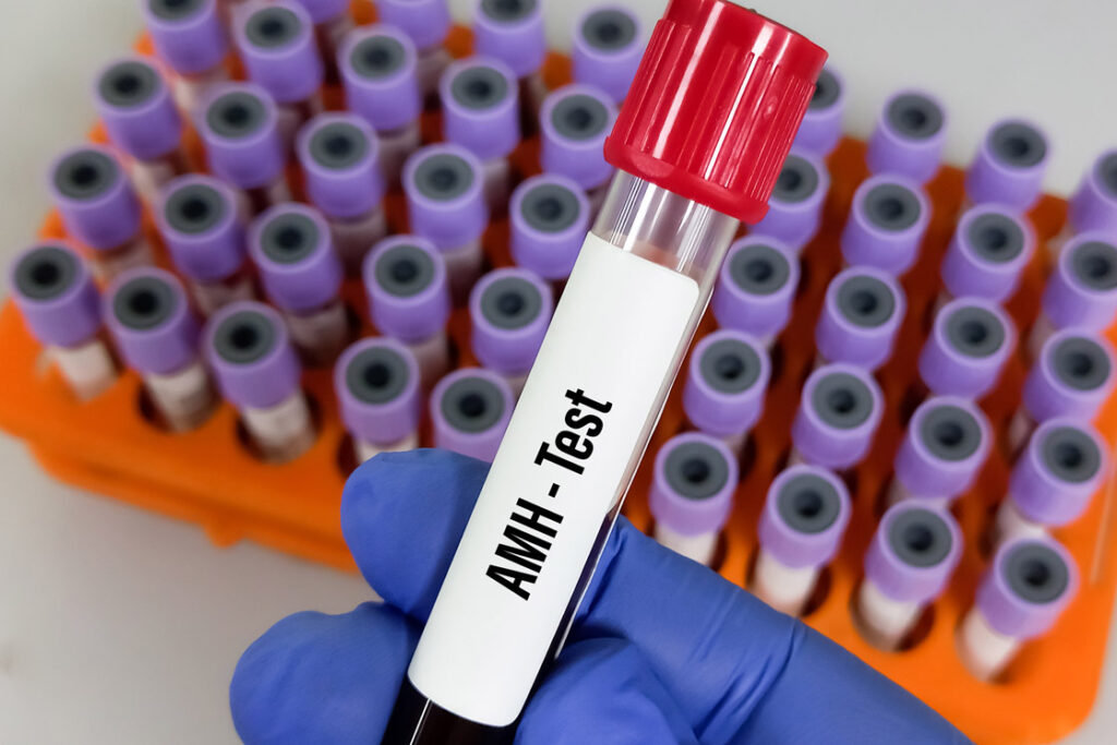 AMH blood test
